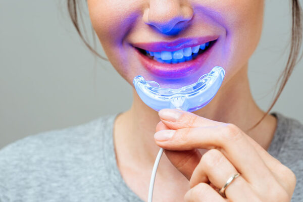 image-post-3 image-post-3